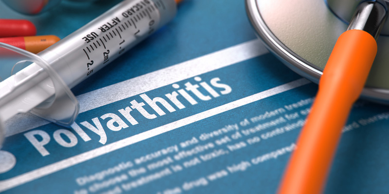 Chronische Polyarthritis