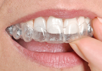 Behandlungsapparaturen