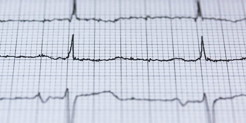 Elektroenzephalografie