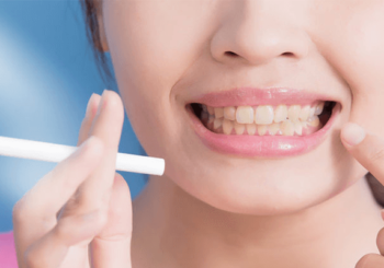 Kaffee-, Nikotin- und Raucherbeläge