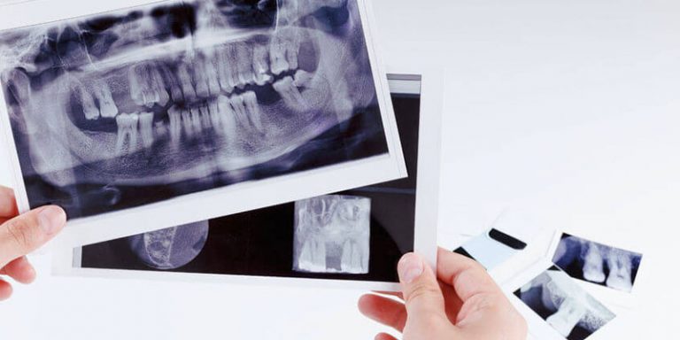 Kieferchirurgie Korrektur Und Behandlung Von Zahnfehlstellungen