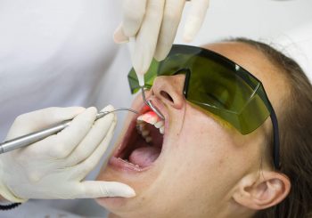 laserbehandlung